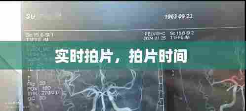 实时拍片，拍片时间 