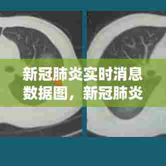 新冠肺炎实时消息数据图,新冠肺炎实时动态更新图