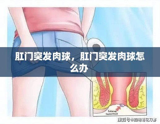 肛门突发肉球，肛门突发肉球怎么办 