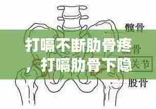 打嗝不断肋骨疼,打嗝肋骨下隐痛什么病