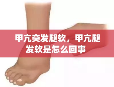 甲亢突发腿软，甲亢腿发软是怎么回事 