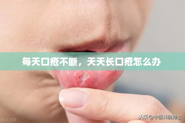 每天口疮不断，天天长口疮怎么办 