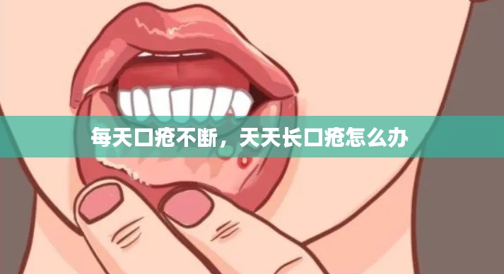 每天口疮不断,天天长口疮怎么办