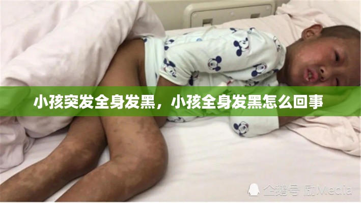 小孩突发全身发黑，小孩全身发黑怎么回事 