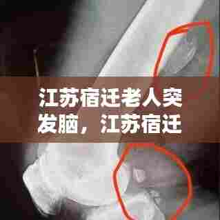 江苏宿迁老人突发脑,江苏宿迁七旬老太