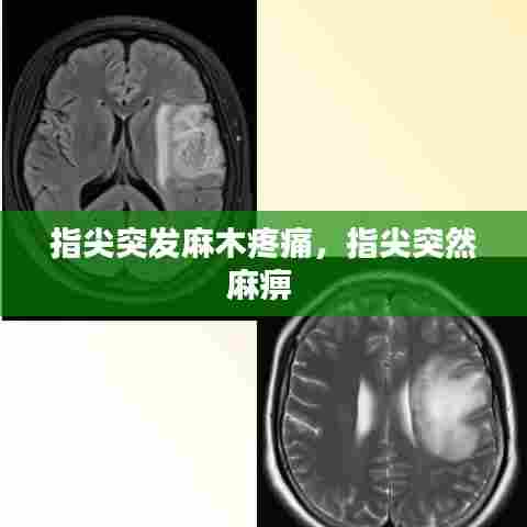 指尖突发麻木疼痛，指尖突然麻痹 