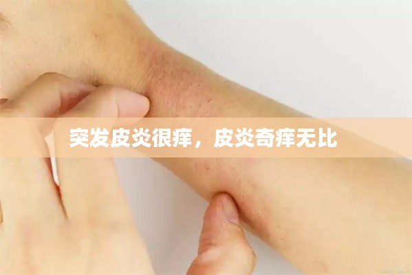 突发皮炎很痒,皮炎奇痒无比