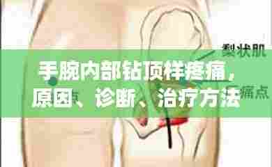 手腕内部钻顶样疼痛，原因、诊断、治疗方法全解析