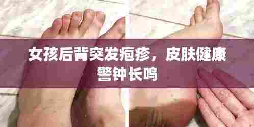 女孩后背突发疱疹,皮肤健康警钟长鸣