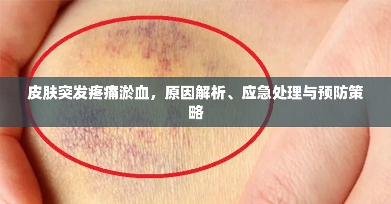 皮肤突发疼痛淤血,原因解析、应急处理与预防策略
