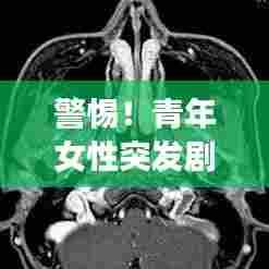 警惕!青年女性突发剧烈头疼,身体紧急信号不容忽视