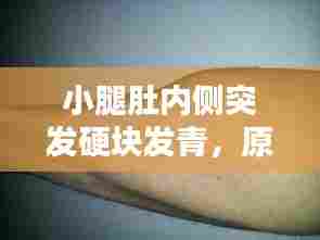 小腿肚内侧突发硬块发青,原因解析与应对策略