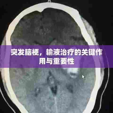 突发脑梗,输液治疗的关键作用与重要性