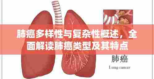 肺癌多样性与复杂性概述,全面解读肺癌类型及其特点